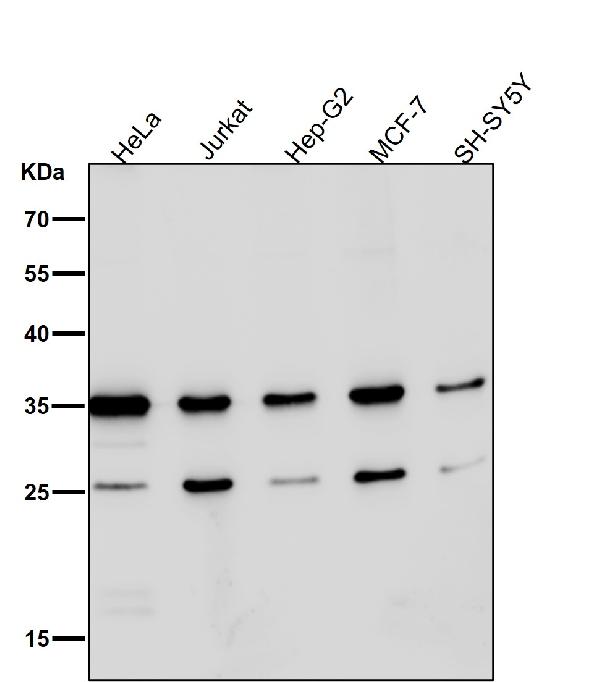 WB - Anti-Phospho-Nucleophosmin (S125) Rabbit Monoclonal Antibody ABO16800